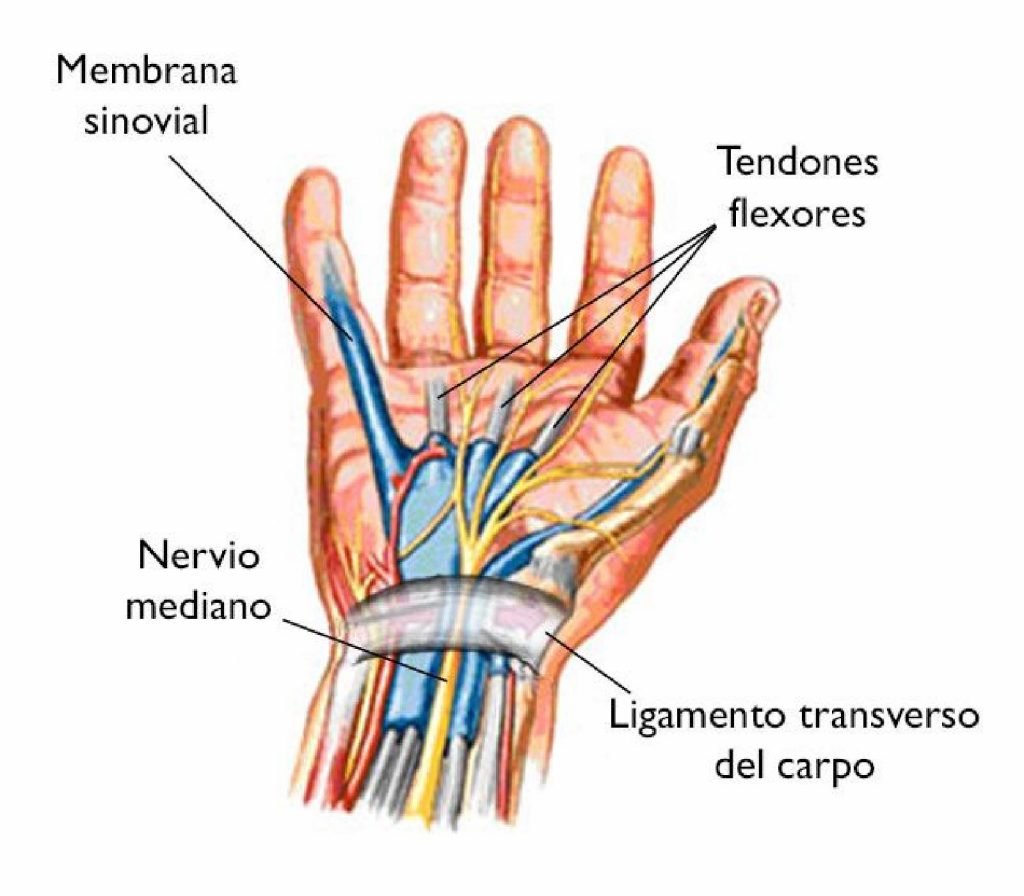 Dolor de Mano Sindrome del Túnel Carpiano